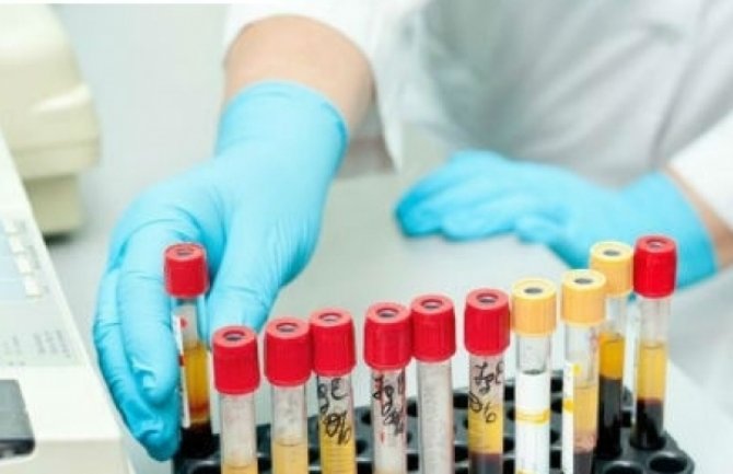 Laboratorijske nalaze će uskoro objavljivati na sajtu