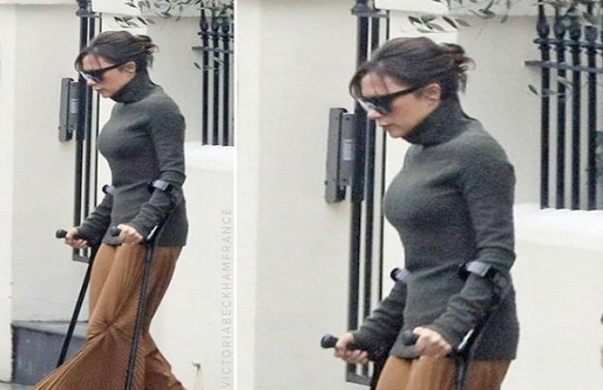 Viktorija Bekam na štakama i u štiklama