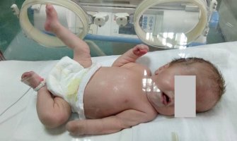 Hitno potrebna pomoć za bebu iz Budve!