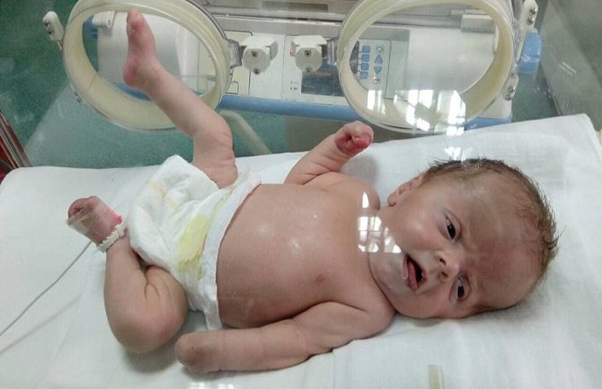 Prikupljen novac za Vanjinu prvu operaciju