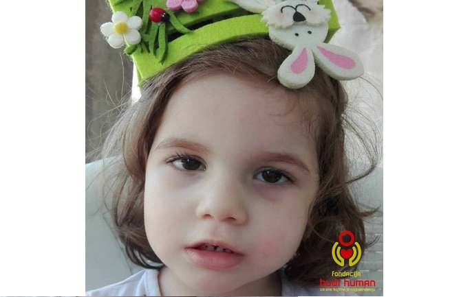 Pošaljite poruku za Ivinu budućnost: Četvorogodišnja djevojčica ne hoda, ne govori, ne koristi ruke