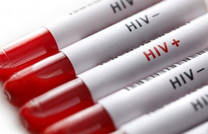 Izliječena druga osoba u svijetu; Pronađen lijek za HIV?