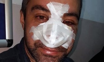 Tomkić: Odbio sam hospitalizaciju da bih sklonio porodicu, sumnjam da policija išta može da uradi