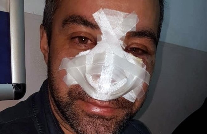 Tomkić: Odbio sam hospitalizaciju da bih sklonio porodicu, sumnjam da policija išta može da uradi