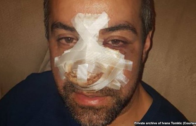 Bjeković: Napad na Tomkića akt vandalizma i bezumlja