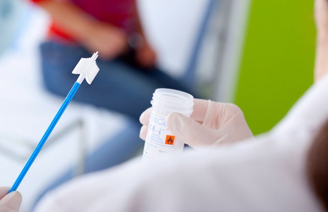 Tri mjeseca ne sprovode testiranja na hlamidiju, nestašica testova