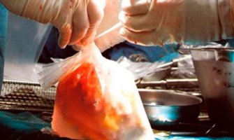 U Prištini uhapšeni ljekari i medicinske sestre zbog trgovine organima