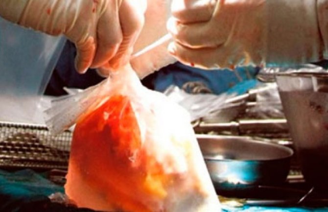 U Prištini uhapšeni ljekari i medicinske sestre zbog trgovine organima