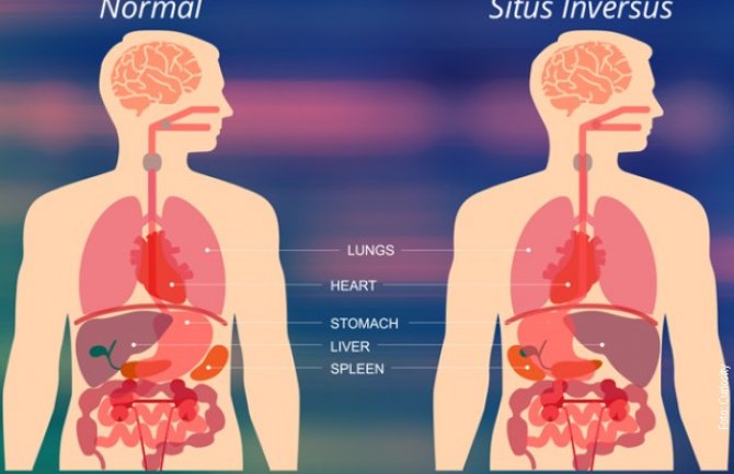 Živjela 99 godina sa obrnutim rasporedom organa u tijelu (FOTO)