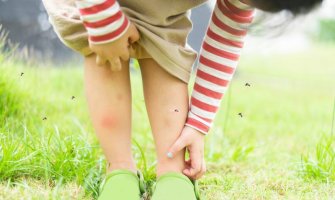 Insekti najviše vole dječju kožu, šta savjetuju ljekari