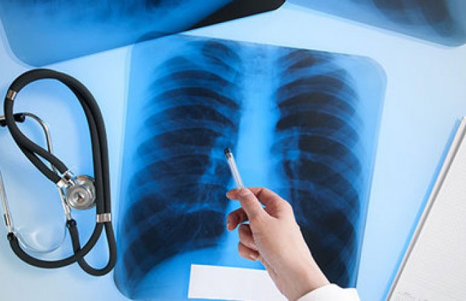 Tri radiologa na 250.000 stanovnika