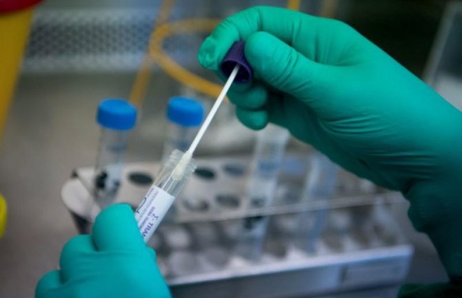 Muškarac iz bolnice u Hrvatskoj negativan na testovima