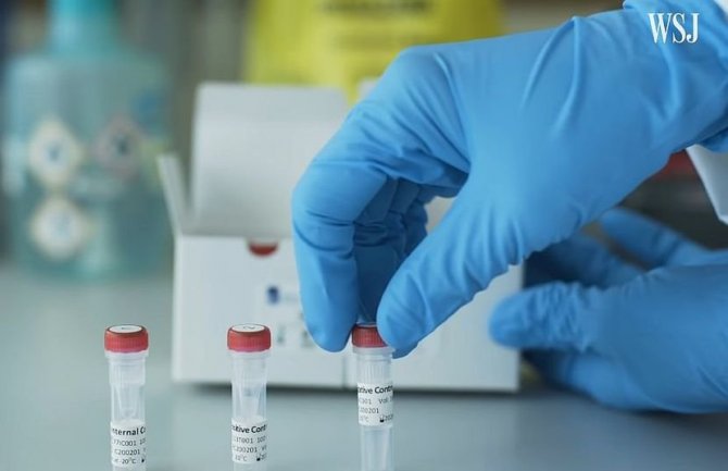 Potvrđeno još 14 slučajeva infekcije novim korona virusom