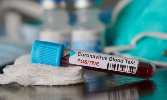 Šest novih slučajeva koronavirusa u CG, Lazović: Nema priključenih na respiratore