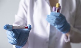 Novih 11 inficiranih koronavirusom, ukupno 120