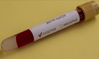 Još 11 zaraženih u Crnoj Gori, ukupno 214