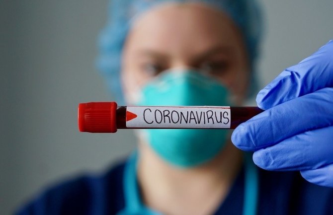 Stigao materijal za testiranje na COVID 19, rješava pojavu lažno negativnih testova