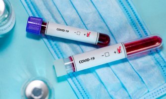 Pet novih slučajeva zaraze koronavirusa, ukupno 288