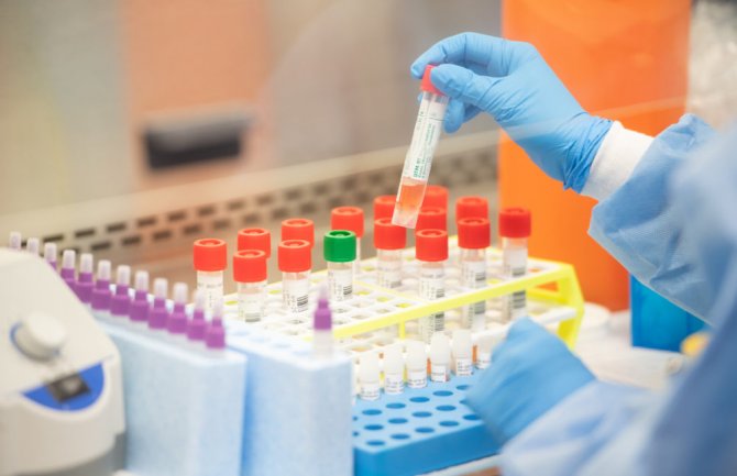 Jedan novi slučaj koronavirusa, 90 osoba se oporavilo