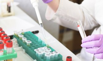 Kompanija Sandoz donirala hidroksihlorokin za liječenje hospitalizovanih COVID-19 pacijenata