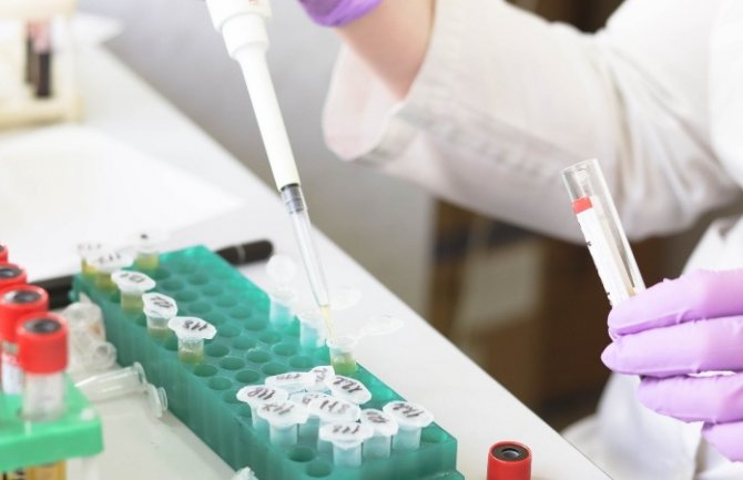 Kompanija Sandoz donirala hidroksihlorokin za liječenje hospitalizovanih COVID-19 pacijenata