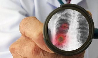 Italija: Najmanje zaraženih u protekla dva mjeseca