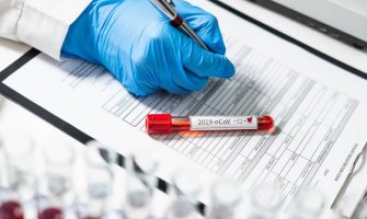 U Crnoj Gori još jedan dan bez oboljelih od koronavirusa