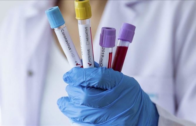 Nema novih slučajeva koronavirusa, oboljelih i dalje četvoro