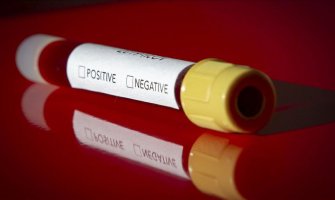 Nema novih slučajeva koronavirusa, jučerašnji pozitivan nalaz ipak bezopasan