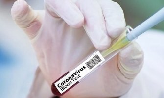 Još jedna osoba preminula u Srbiji, 71 novozaražena