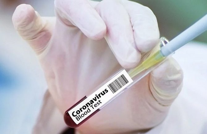 Još jedna osoba preminula u Srbiji, 71 novozaražena