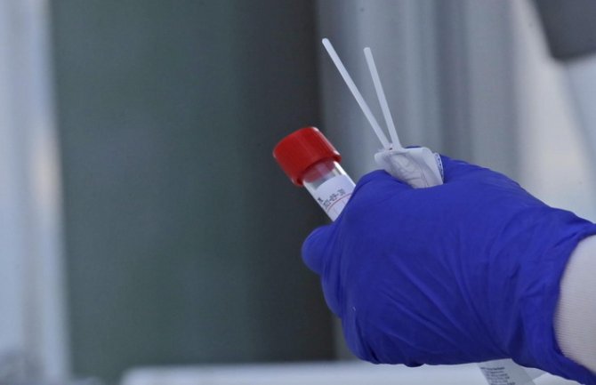 Srbija: Tragedija u Čačku, dva brata preminula od posljedica koronavirusa