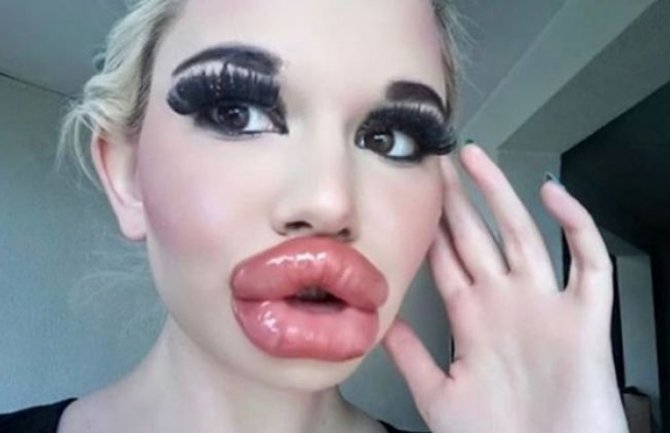 Ovo je vlasnica najvećih usana na svijetu (FOTO)