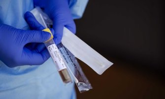 Analizirano 148 uzoraka, svi negativni