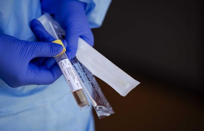 Analizirano 148 uzoraka, svi negativni