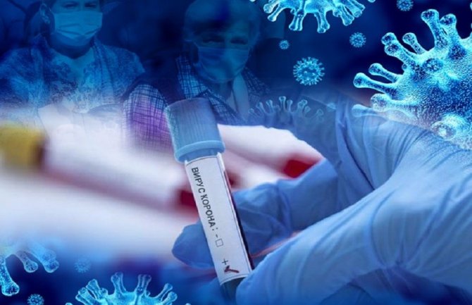 Još 15 novih slučajeva koronavirusa, ukupno 115