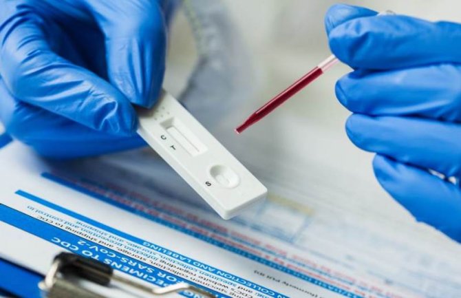 Raste broj oboljelih od koronavirusa u CG: Još 66 inficiranih, najviše iz Podgorice