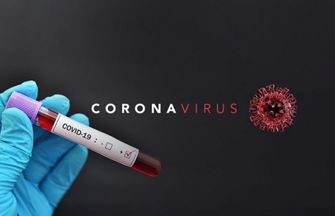 Još 59 novooboljelih, dva pacijenta preminula, 21 oporavljen