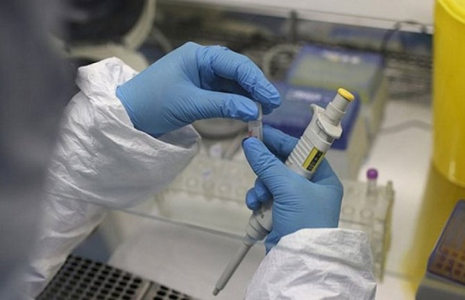 Test za koronavirus morao da plati 450 eura