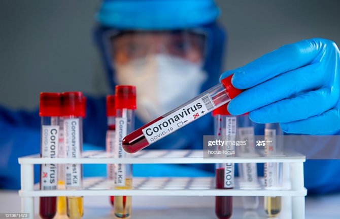 U svijetu koronom zaraženo 7.359.858 osoba