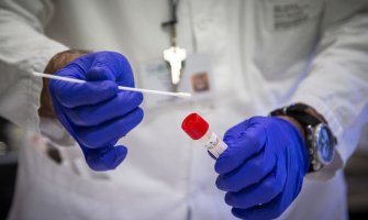 Povukli Rendoks testove za koronvirus iz bezbjednosnih razloga