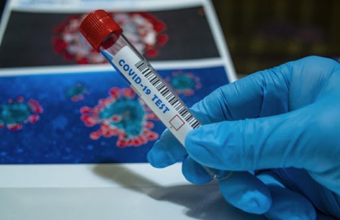 U Crnoj Gori danas 30 inficiranih, dvije osobe preminule