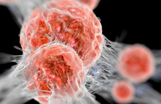 Liječenje kancera biće mnogo efikasnije od 2028. godine