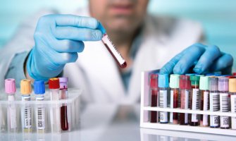  Još 48 inficiranih, jedna osoba izgubila život