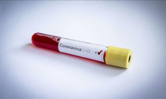 U Crnoj Gori najviše aktivno oboljelih na milion stanovnika