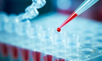 Jedna osoba preminula od koronavirusa, još 187 novopozitivnih