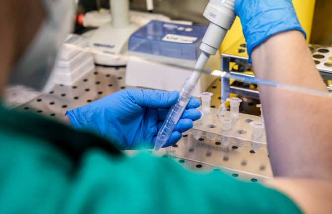 Opet veliki broj zaraženih: 289 novopozitivnih, 3 smrtna slučaja