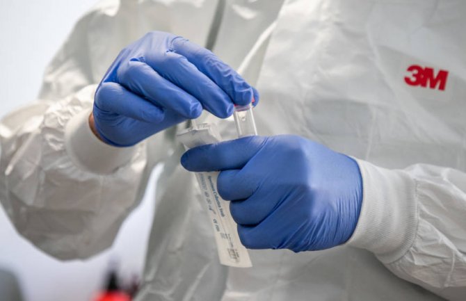 Još 130 oboljelih, iz Njemačke stigli rezultati - čak 573 potvrđena slučaja infekcije