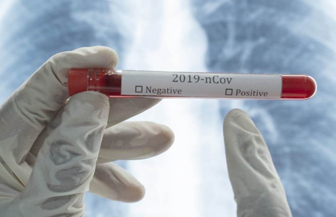 Crna Gora i Slovenija sa najviše aktivno oboljelih 