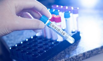 Još 465 slučajeva korone, jedan pacijent preminuo 